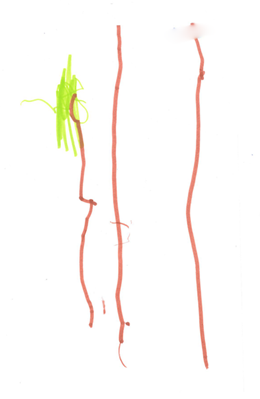 ML's Tree